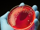 USDA aims to reduce salmonella with Grand Challenge