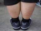 Study: 268 million children may be overweight by 2025