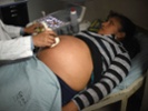 CDC: Many women overweight, obese at prepregnancy