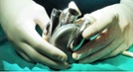 BiVACOR's titanium heart enters FDA's TAP program