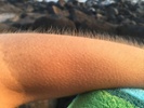 What causes goosebumps?