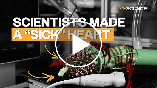 New robotic heart can mimic the different stages of heart failure