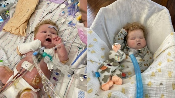 1st-of-its-kind heart transplant in infant could prevent organ rejection