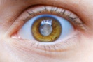 Human eye with cloudy lens